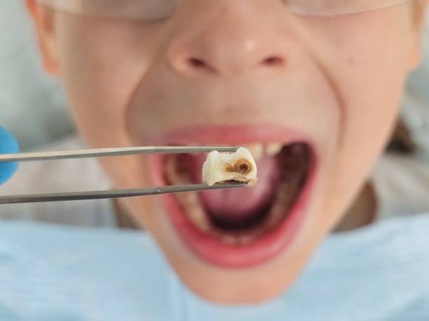 Best Emergency Dental Services for Seniors in Calcutta, OH